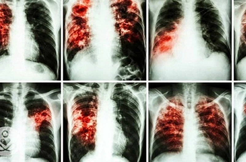 Προσοχή! Είναι πιο καρκινογόνα και από το κάπνισμα και όλοι τα χρησιμοποιούμε καθημερινά